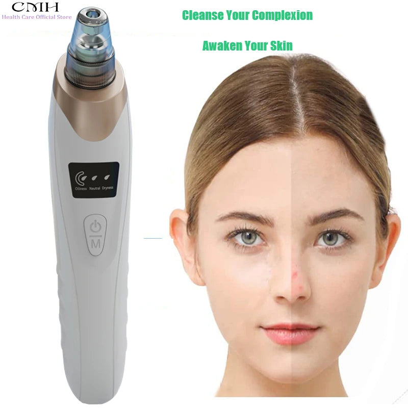 Blackhead Vacuum Remover
